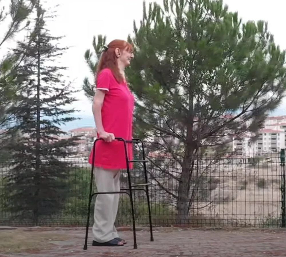 Dünyanın en uzun kadını: Rumeysa Gelgi